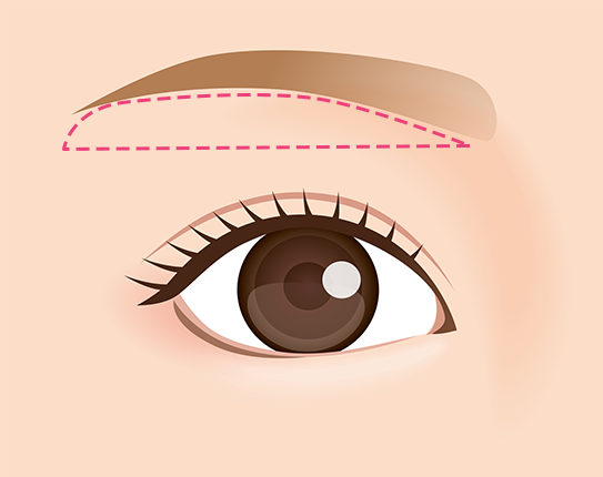 眉下リフトについて