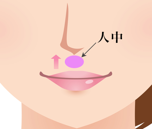 人中短縮(リップリフト)について