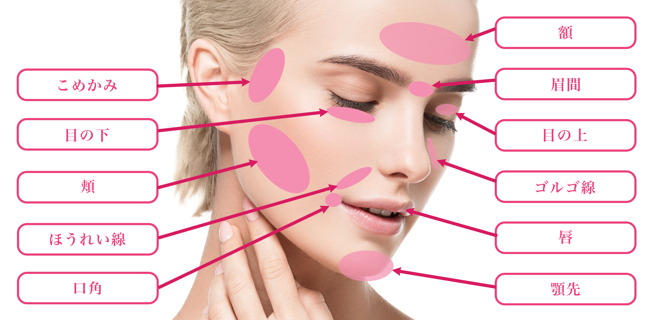 脂肪注入対象部位(顔)