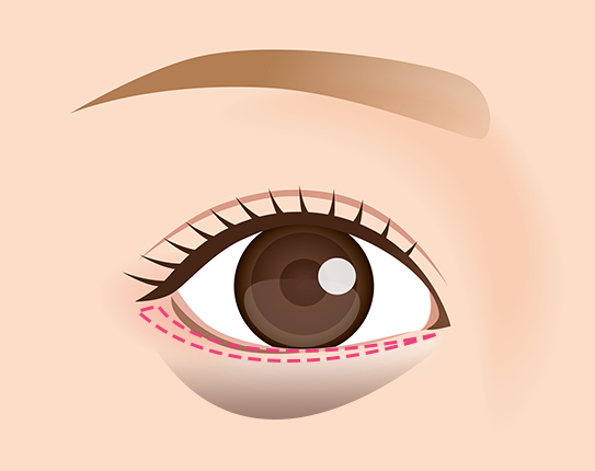 切るクマ取り_素材①