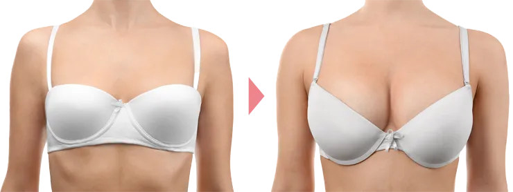 バストサイズ・デザインを細かく調整