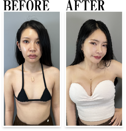 ビフォー・アフター