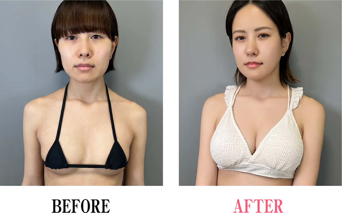 ビフォー・アフター