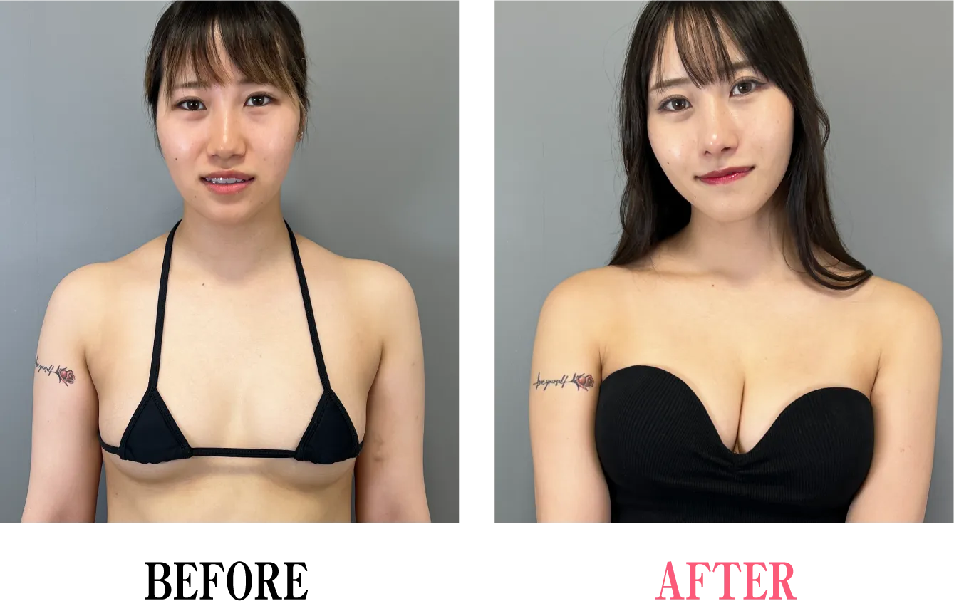 ビフォー・アフター