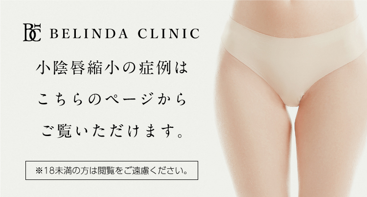 小陰唇縮小の症例はこちらのページからご覧頂けます