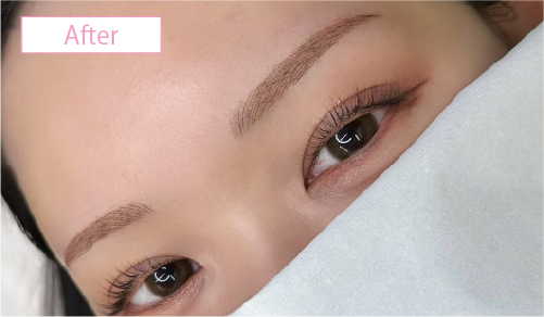 アートメイク症例アフター