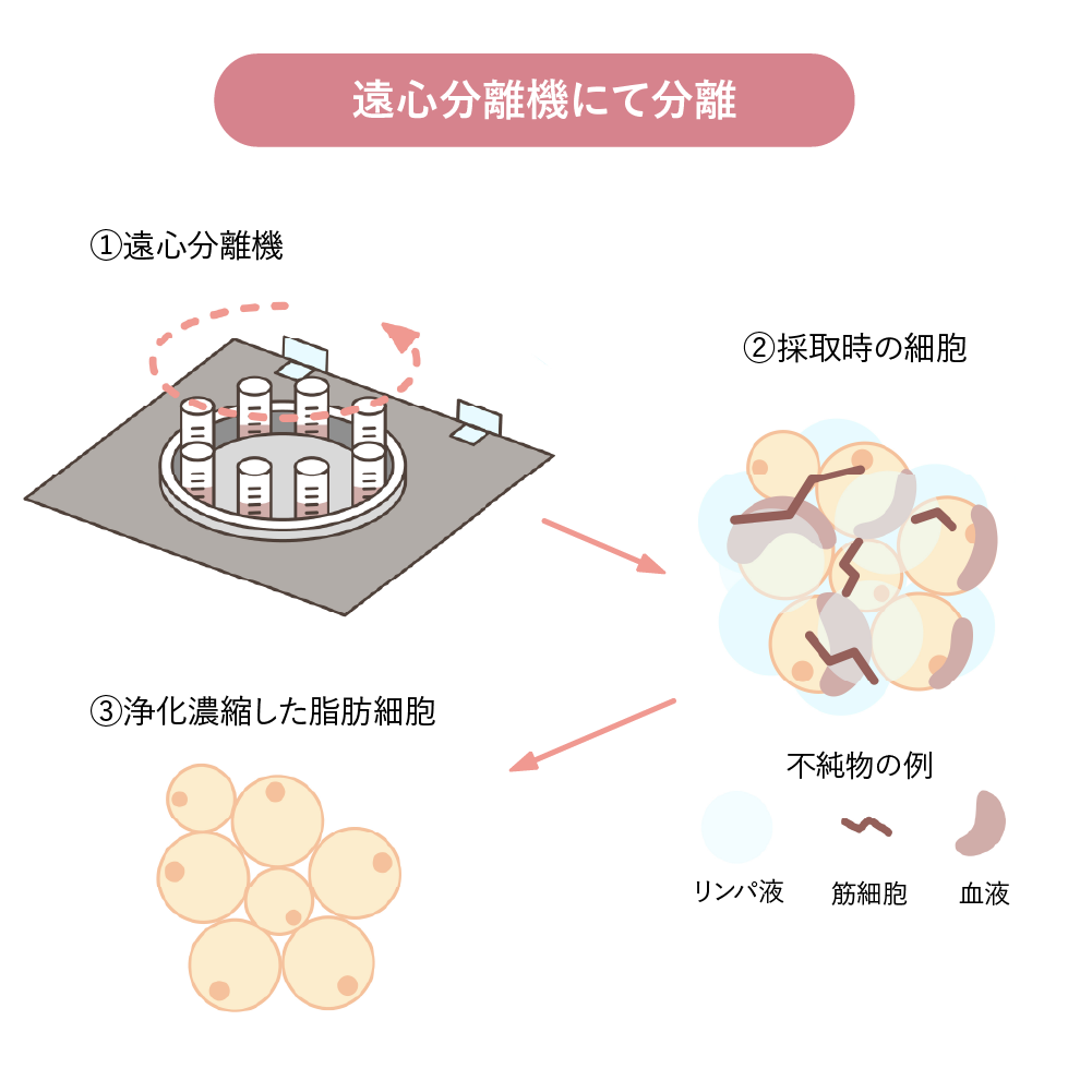 脂肪を遠心分離機にて分離