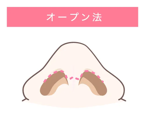 オープン法イメージ