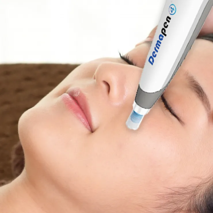 エクソソームダーマペン4施術イメージ