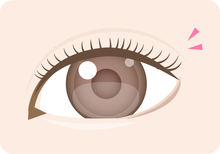 二重が取れる・緩んでしまうイメージ