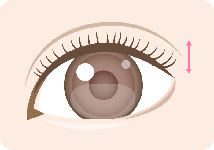 幅広の二重イメージ