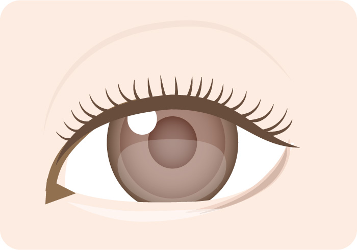 腫れぼったいまぶたのイメージ