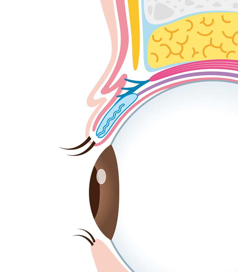 06,二重施術完了の説明画像