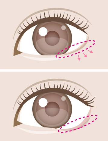 グラマラスラインイメージ