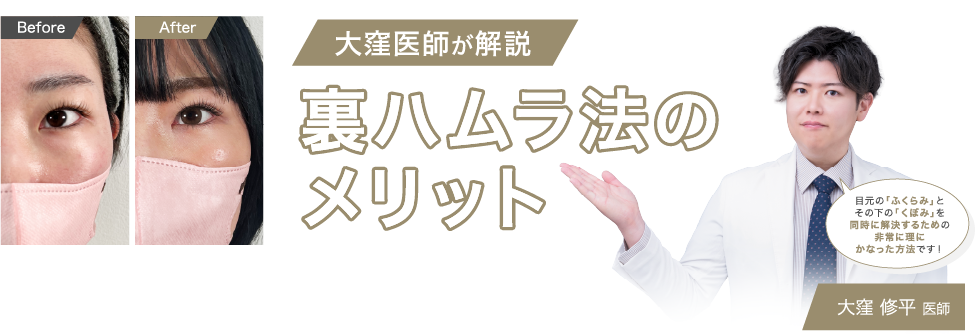 大窪医師が解説・裏ハムラ法のメリット