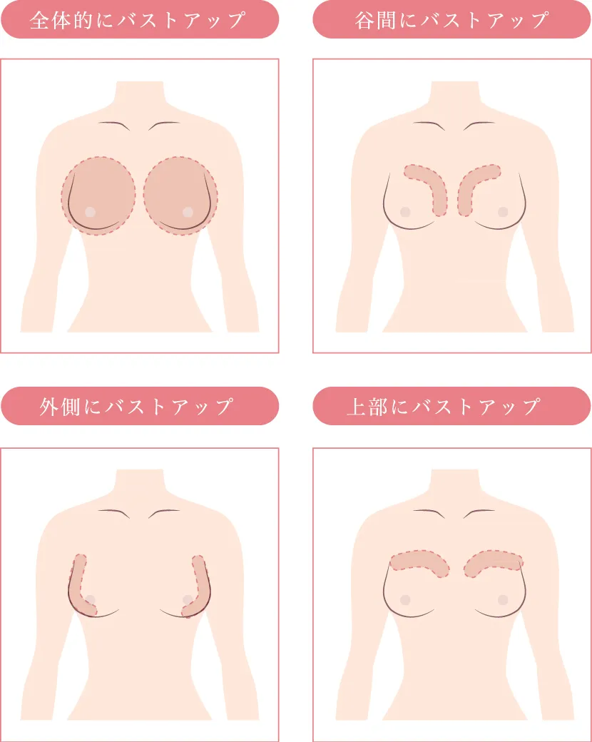 ヒアルロン酸オーダメイドイメージ