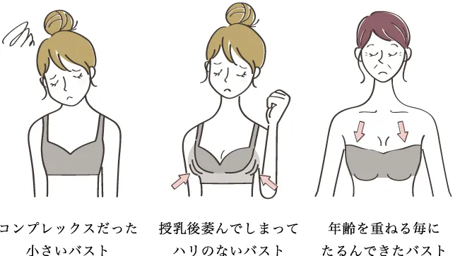 コンプレックスだった小さいバスト・授乳後萎んでしまってハリのないバスト・年齢を重ねる毎にたるんできたバスト