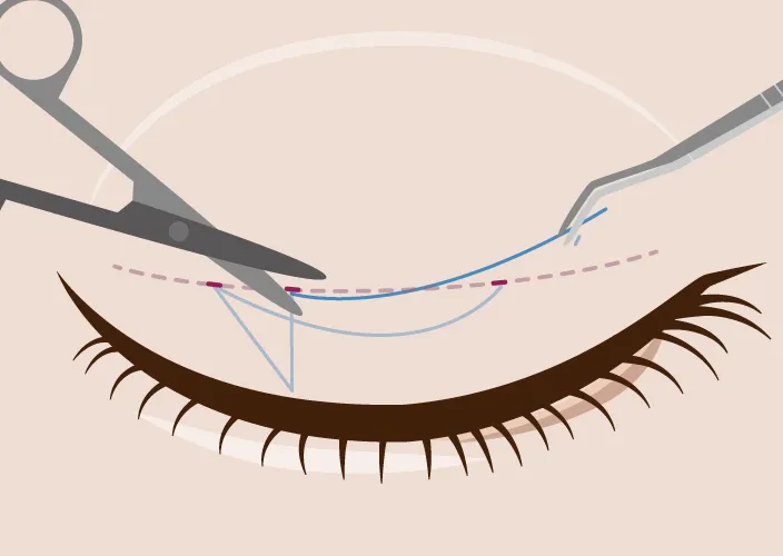 二重修正メインイラスト