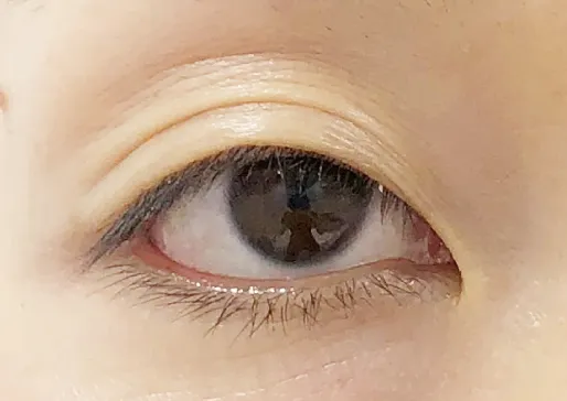 二重の幅が変わる・薄くなるイメージ