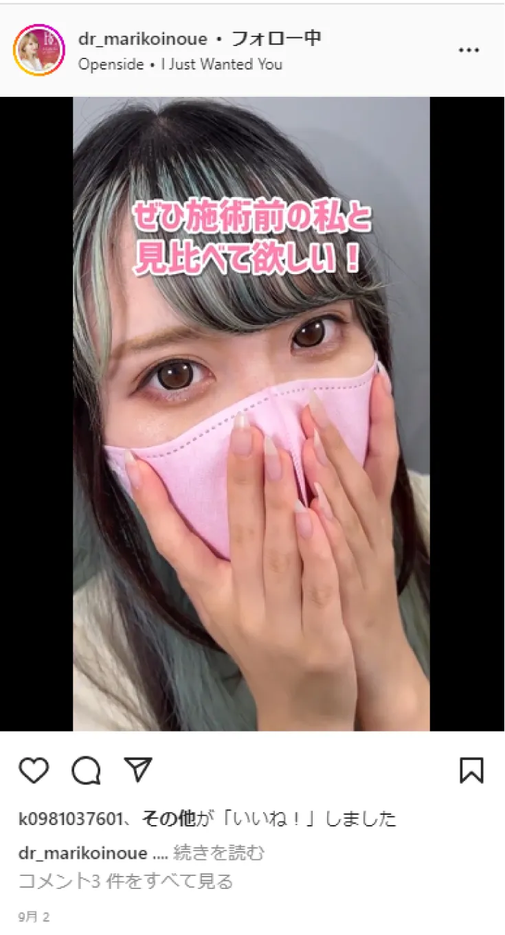 SNSで人気のまりこ先生の二重術イメージ