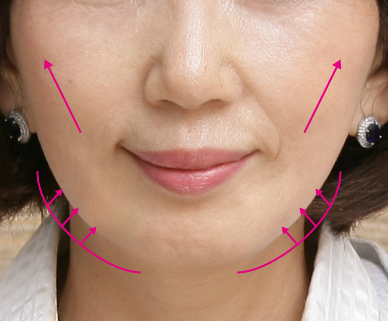 引き締め画像after