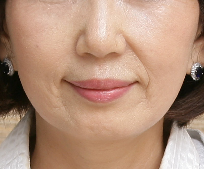 引き締め画像before