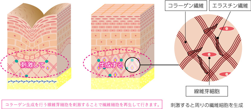 コラーゲン繊維・エラスチン繊維の生成画像
