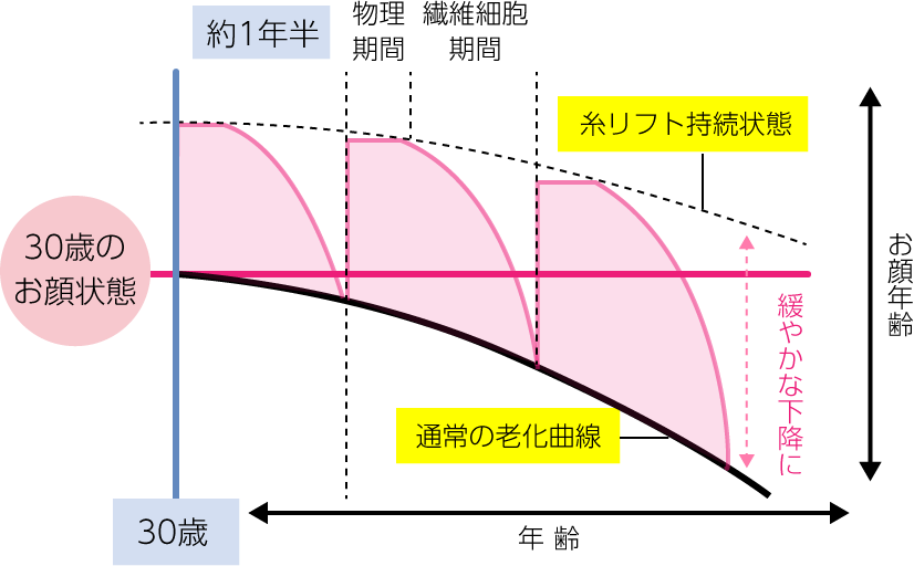 糸リフト効果維持表