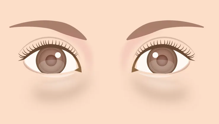 目の下のクマイラスト