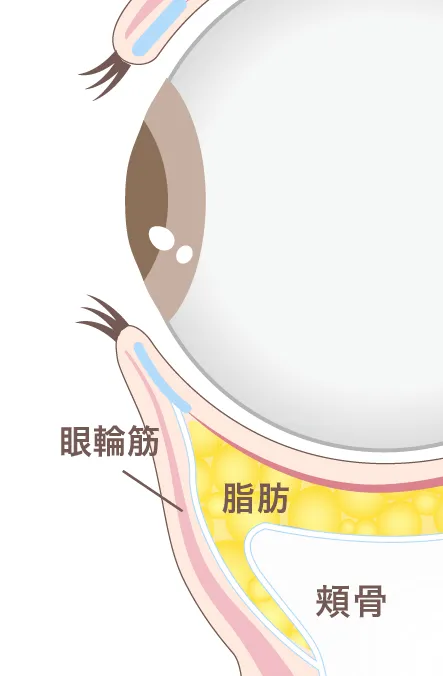 眼窩脂肪イメージ01