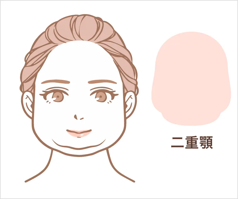 顔・二重顎型イメージ