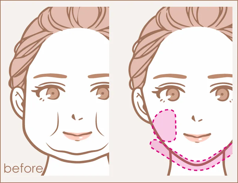 脂肪を減らすイラスト