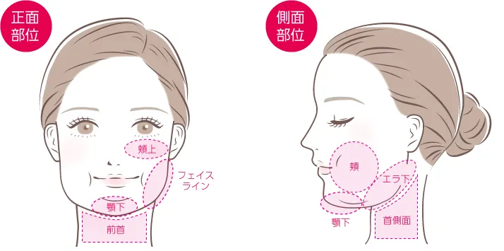 頬(頬上)・フェイスライン・顎下・エラ・首