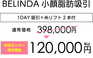 BELINDA小顔脂肪吸引 モニター価格120,000円(税込)
