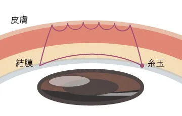 ブリリアント・スクエア裏留シークレット法