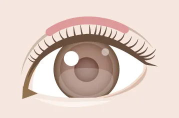 ティナラインイメージ画像