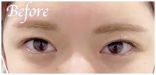 すずかちゃんbefore