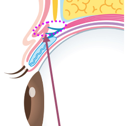 二重まぶたの断面イラスト