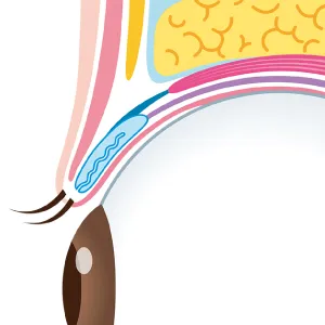 一重まぶたイメージ