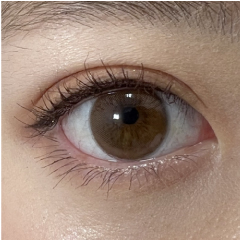 平行型二重画像