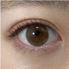 平行型二重画像