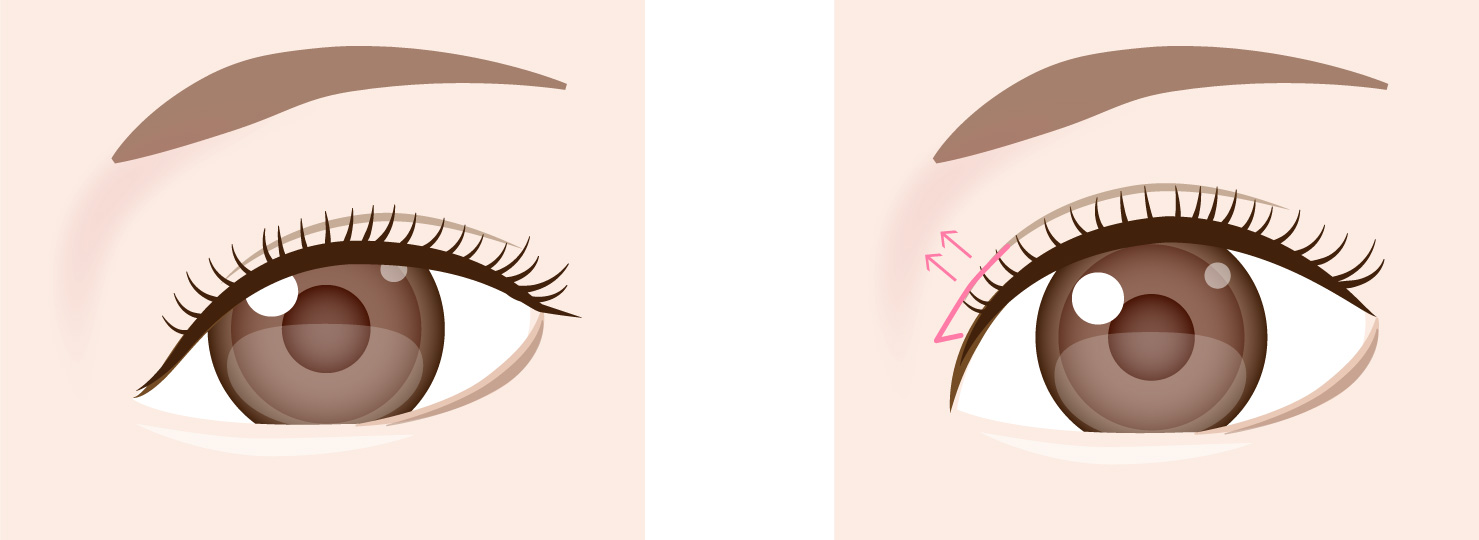 施術による変化のイメージ