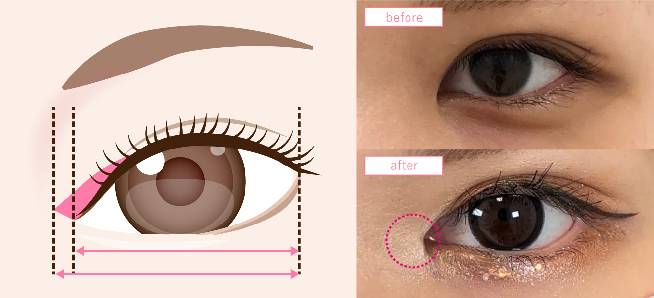 目頭切開|切開部位と変化の違いのイメージ