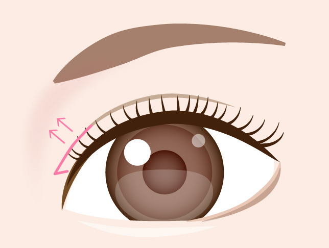 施術による変化のイメージ