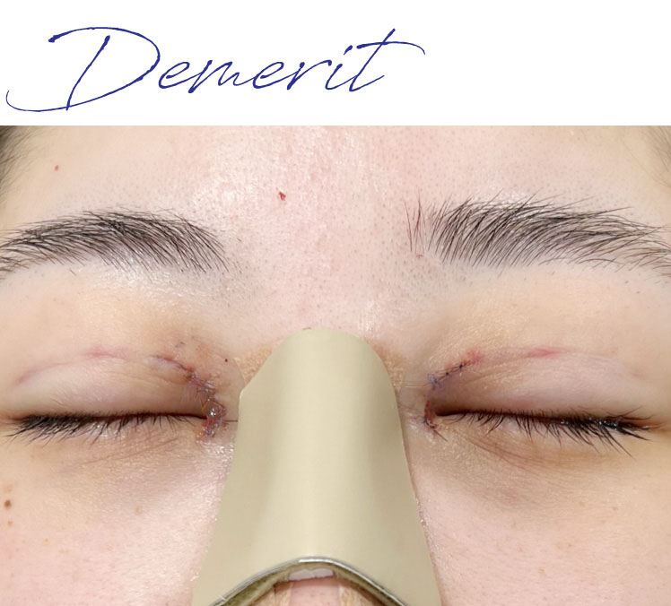 イメージ:デメリット