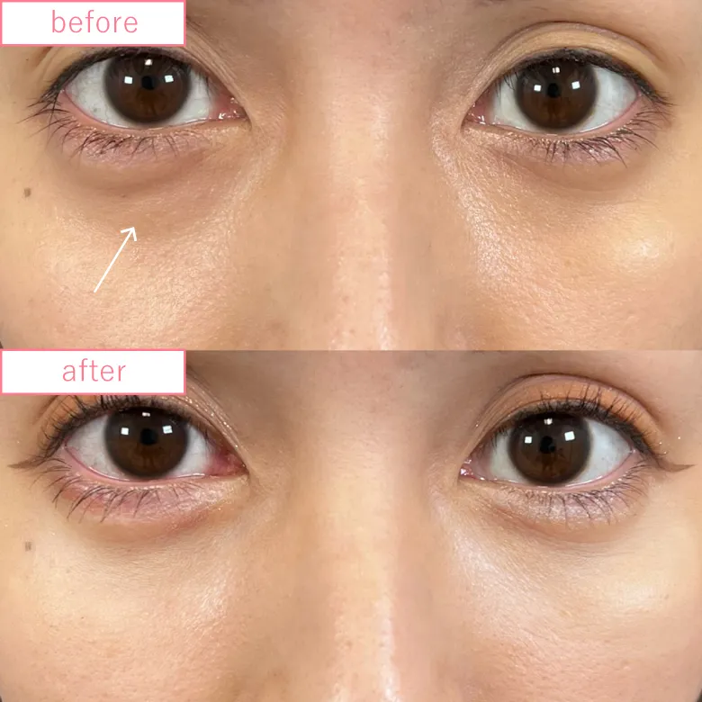 ねもやよさんクマ取りイメージ