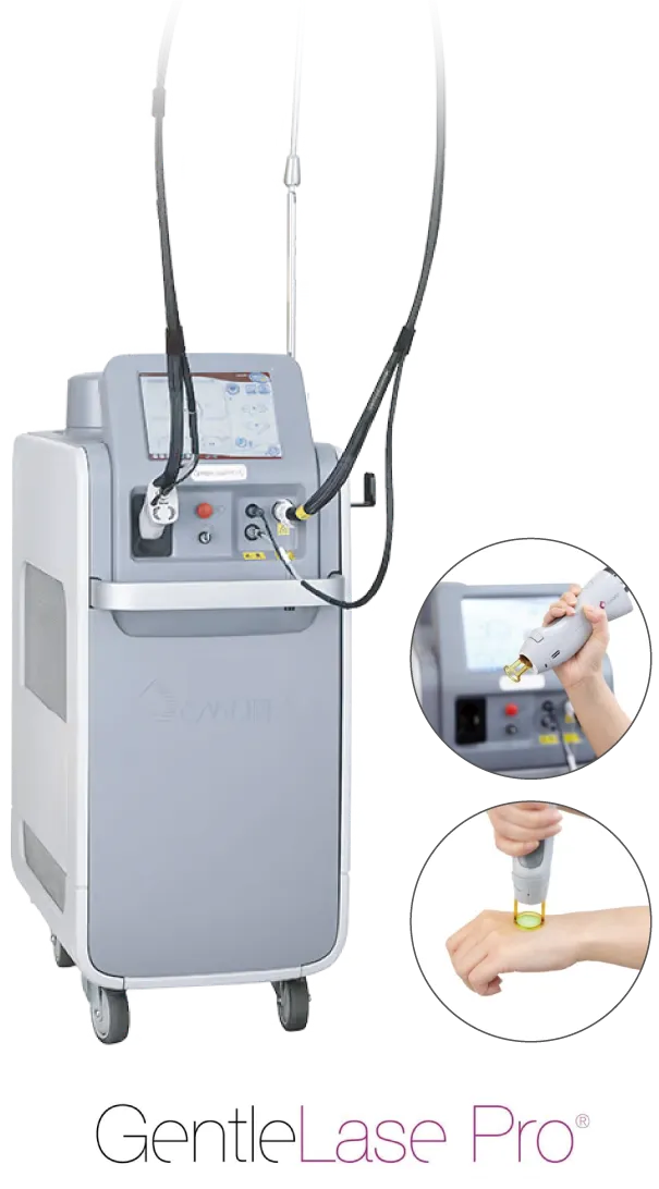 ジェントルレースの画像