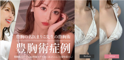 まりこ先生豊胸症例