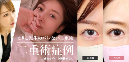 まりこ先生二重症例