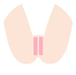 Iラインを示すイラスト